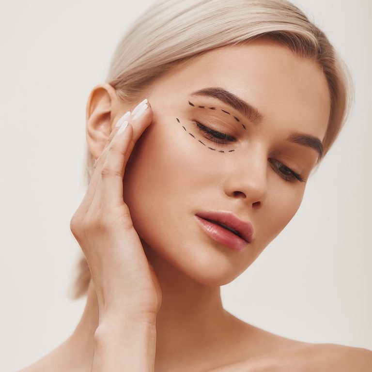 idealbody-eyelid-surgery