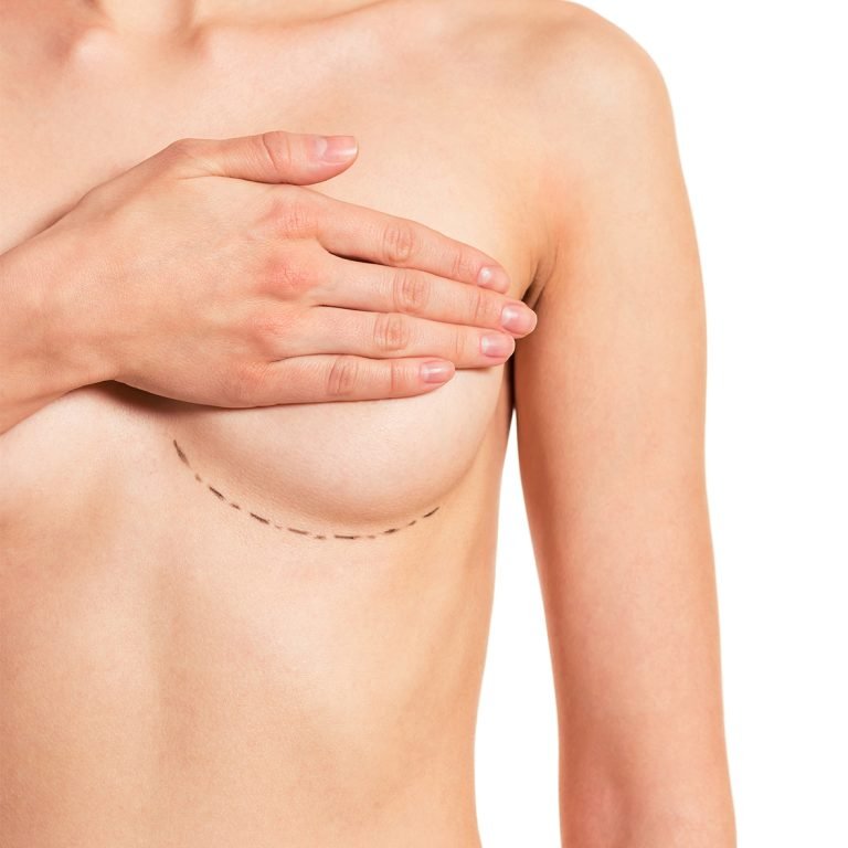 idealbody-meme-diklestirme